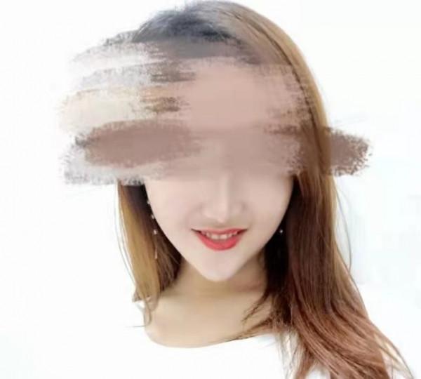 盲目追求瓜子臉,將自己整成這樣,血淋淋的教訓 盲目追求瓜子臉,將自己整成這樣,血淋淋的教訓