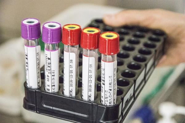 癌胚抗原升高，是得了癌症嗎？6種腫瘤標誌物，需重點關注