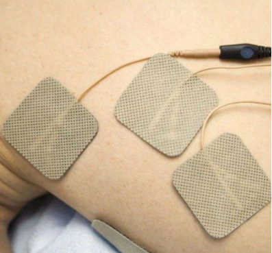 治療動力性腰肌勞損，電針灸、低中頻脈衝電療法效果更好