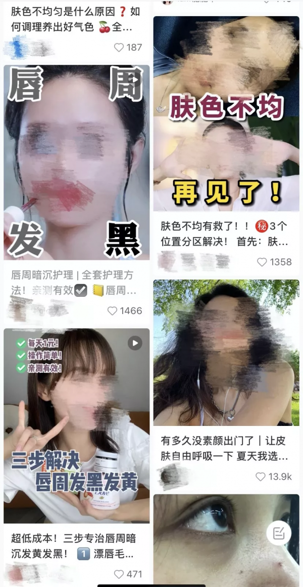 醜哭!唇周暗沉自救指南,做好這3件事讓你白回來 醜哭!唇周暗沉自救指南,做好這3件事讓你白回來