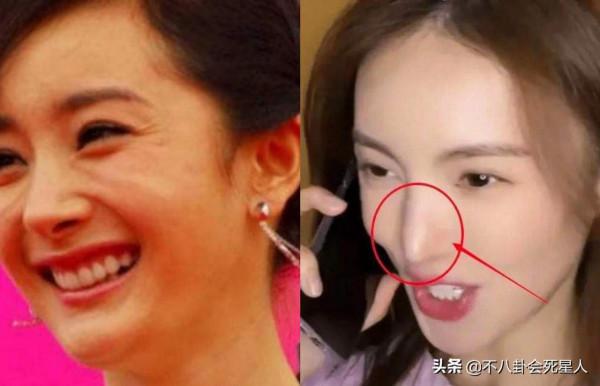 那些亂整鼻子的女明星還好嗎？後遺症一大堆，楊冪金晨都開始崩了