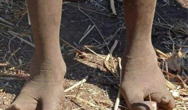 “龍蝦民族”只有兩個腳趾,科學家研究結果或許顛覆了進化理論 “龍蝦民族”只有兩個腳趾,科學家研究結果或許顛覆了進化理論