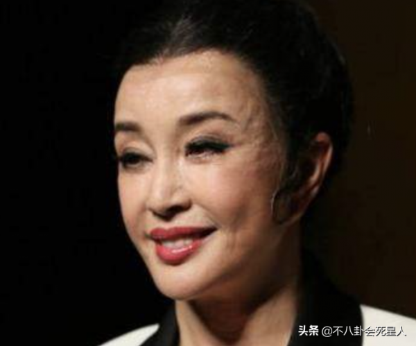 中年女星整容後遺症一堆！臉像鞋拔子，不敢做大表情，演戲沒法看