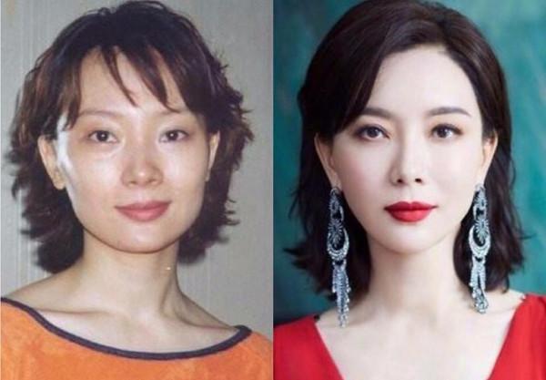 8位“換頭改命”的女明星，楊紫臉蛋已僵硬，鞠婧禕靠換頭出圈