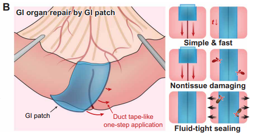 華人團隊發明手術級強力膠帶：快速外科止血，拯救成千上萬生命