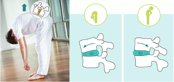 腰間盤突出就不能練瑜伽了嗎？