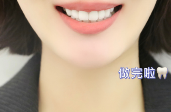 都美竹走出陰影開始接廣告,粉絲嘲諷換個牙都擺拍 都美竹走出陰影開始接廣告,粉絲嘲諷換個牙都擺拍