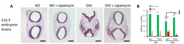 112萬新生兒資料顯示:孕媽高血糖,寶寶心臟缺陷高出66% 112萬新生兒資料顯示:孕媽高血糖,寶寶心臟缺陷高出66%