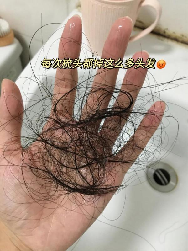 發縫真的被我養窄了！養髮技巧真的有用