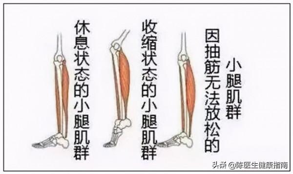 老人腿抽筋真的是因為缺鈣嗎？闢謠：小腿痙攣，警惕2種疾病
