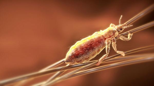 30年前人身上常見的蝨子,為何如今看不到了? 30年前人身上常見的蝨子,為何如今看不到了?