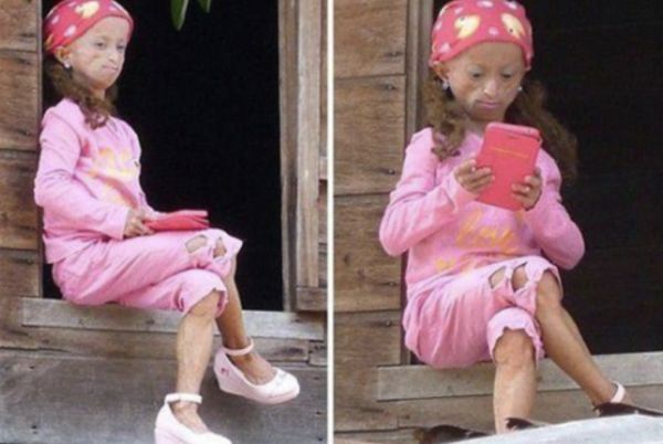 菲律賓16歲美少女,突然變成60歲老太太,顯得比母親還老,為啥? 菲律賓16歲美少女,突然變成60歲老太太,顯得比母親還老,為啥?