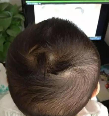 你頭上有幾個旋？