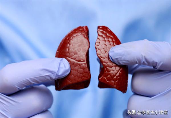 如何讓你的肺結節變小或者消失? 如何讓你的肺結節變小或者消失?