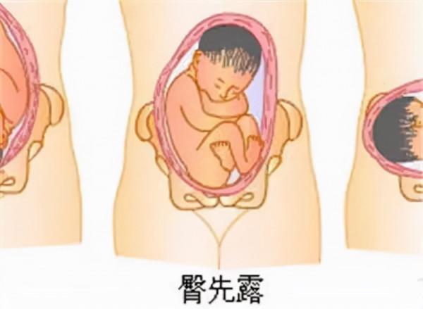 26歲女子“困”在兒童身體裡像被“凍齡”!醫生:腦子裡“零件”壞了,修不好 26歲女子“困”在兒童身體裡像被“凍齡”!醫生:腦子裡“零件”壞了,修不好