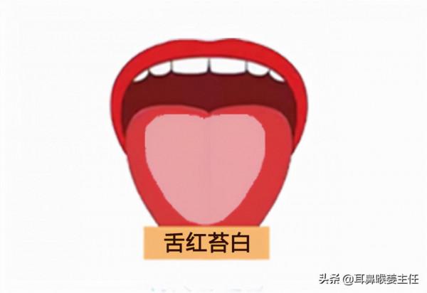 慢性咽炎用中醫如何調理？