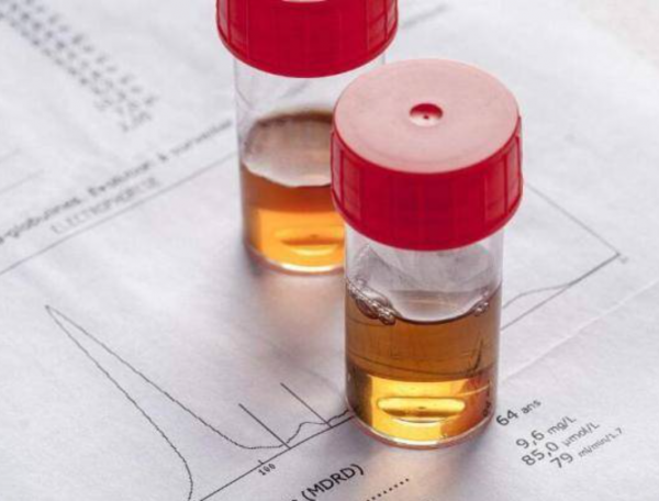 腎病怎麼避免成為尿毒症？做好2個指標檢測，早發現早治療很重要