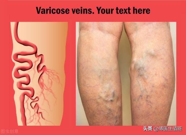 男子下肢瘙癢，長滿潰瘍就醫，醫生嘆氣：已經成老爛腿了