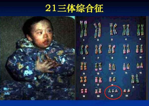 ​孕中期產檢:重要專案及檢查時間,關乎母子健康,一次都別落下 ​孕中期產檢:重要專案及檢查時間,關乎母子健康,一次都別落下