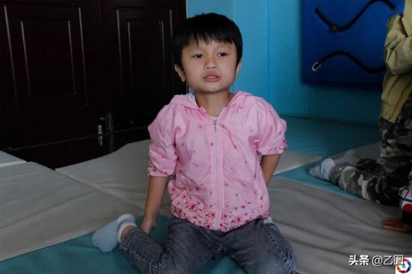 女童出生時腸子露在外面,醫生將其救活,未料幾個月後又遭重擊 女童出生時腸子露在外面,醫生將其救活,未料幾個月後又遭重擊