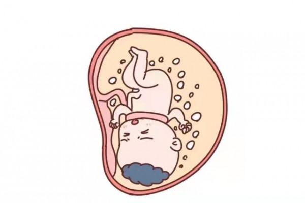 罕見！胎兒臍帶繞頸4周！還能夠脫困嗎？