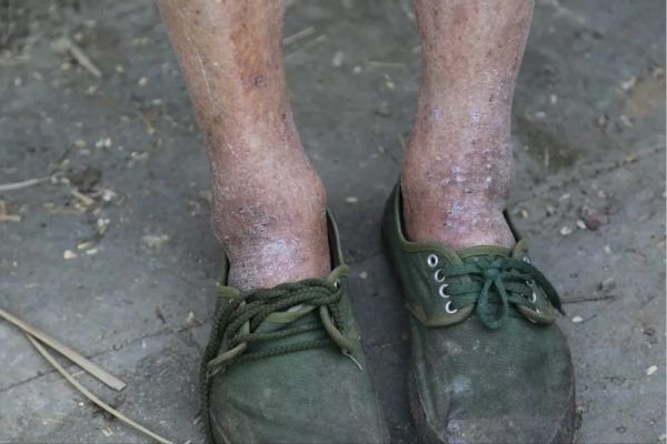 比抗戰老兵命運更悲慘的騰衝民夫到底有多慘？