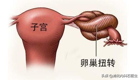 9歲女童腹痛休克，7天無緩解，開腹後醫生無奈：系膜轉了520&deg;