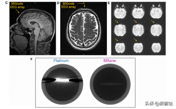 用於多尺度電生理學和刺激的 Mxene柔性電極 注入生物電子介面 用於多尺度電生理學和刺激的 Mxene柔性電極 注入生物電子介面