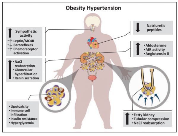2萬人研究發現：“曾經胖過”也易得高血壓，如何降壓減肥？AHA來支招