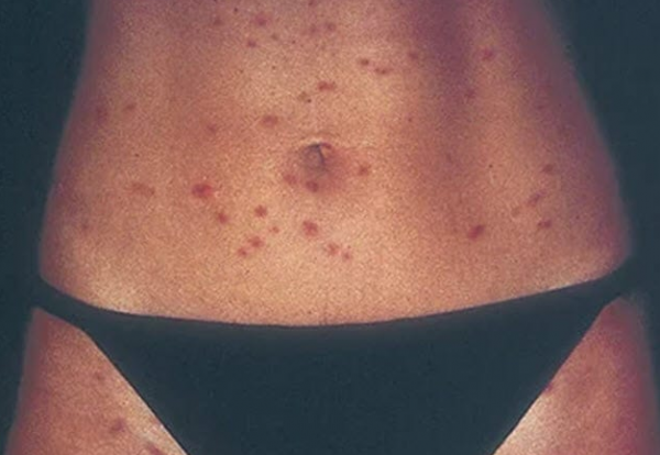 潛伏在海灘的10大危險隱患，喜歡大海的朋友要小心了（上）