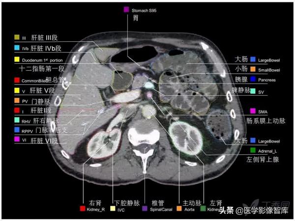 CT斷層解剖圖譜最全總結「推薦收藏」 CT斷層解剖圖譜最全總結「推薦收藏」
