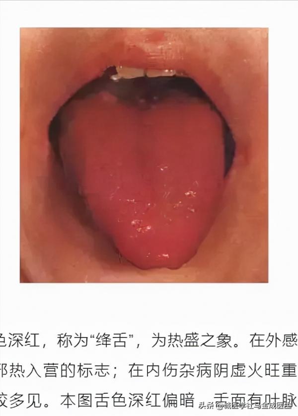 六種不同常見體質，看你屬於哪種，看哪種方法適合你