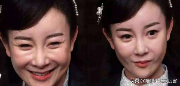 整形演員的春天要結束了?滿屏塑膠臉、人造臉該消停了 整形演員的春天要結束了?滿屏塑膠臉、人造臉該消停了