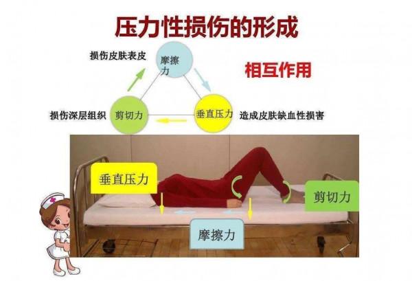 老人股骨頸骨折，關節置換，還是螺釘固定？看看醫生怎說