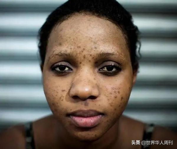 為了美白,非洲姑娘能有多拼? 為了美白,非洲姑娘能有多拼?