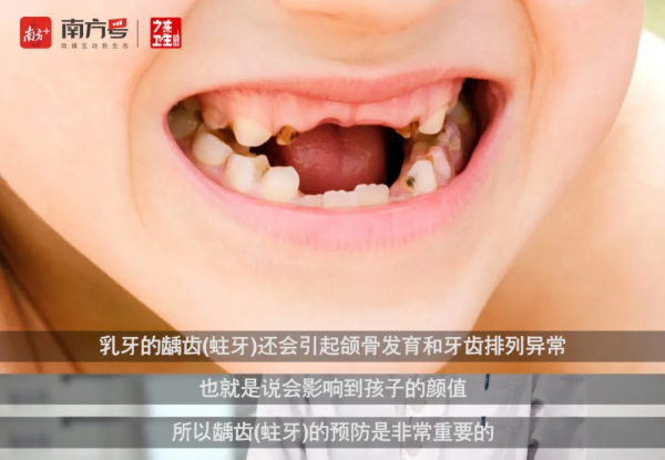 牙線會讓牙縫變大?你最關心的兒童牙齒問題,都能在這找到答案 牙線會讓牙縫變大?你最關心的兒童牙齒問題,都能在這找到答案