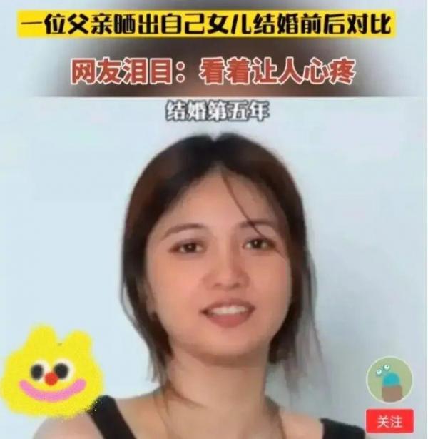 父親曬女兒結婚10年的變化直呼心疼,網友:別曬了,男的變化更狠 父親曬女兒結婚10年的變化直呼心疼,網友:別曬了,男的變化更狠