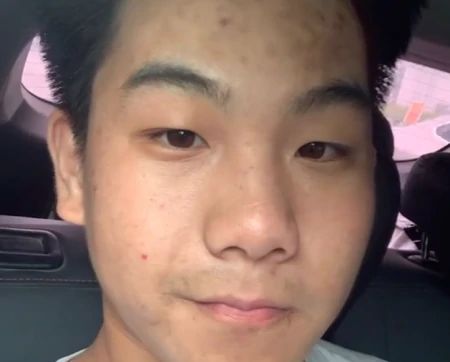 山東男生暴飲暴食胖到近200斤，半年後的照片網友直呼：成功逆襲