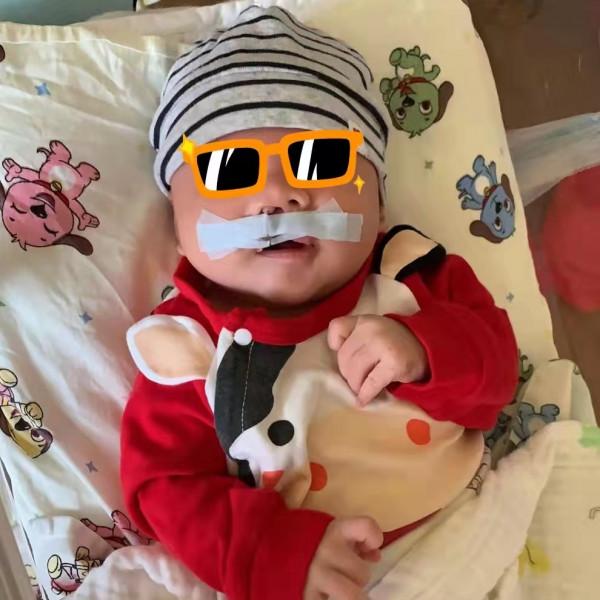 寶寶是一隻“小兔子”，還沒長牙就要開始正畸了