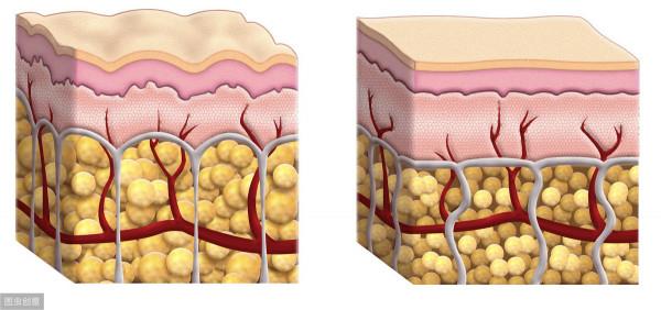 膽固醇、甘油三酯、脂蛋白超標？血脂與日常飲食關係多大？怎麼調