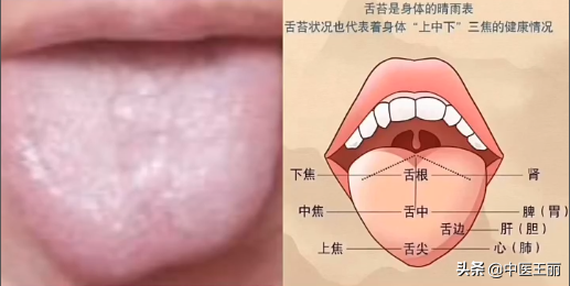 最近整理了一些粉絲的舌診分析，大家可以看看（每日舌象分析）