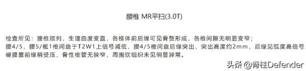 實錄｜我的腰椎間盤突出