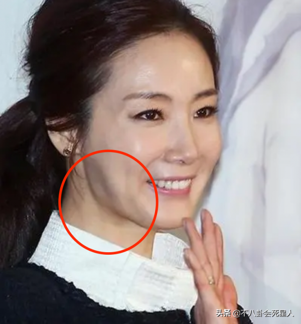 那些紅極一時的韓流明星,終於被整容後遺症給拖累了 那些紅極一時的韓流明星,終於被整容後遺症給拖累了