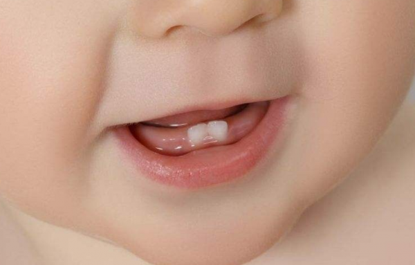 寶寶總流口水 不只是在長牙 寶寶總流口水 不只是在長牙