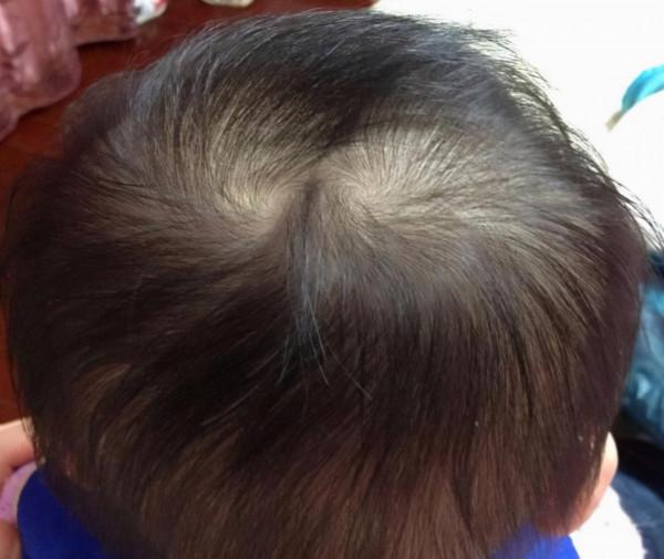 “雙頂男孩找不到，雙頂女孩沒人要”，雙頂指啥？有道理嗎？