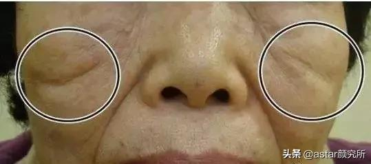 拉垮顏值的“印第安紋”，終於找上了95後