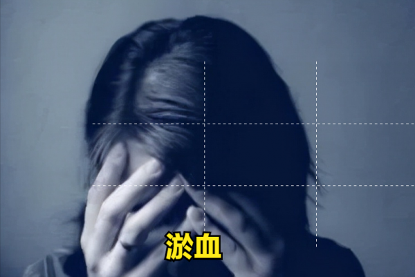 中醫如何判斷和治療抑鬱症 中醫如何判斷和治療抑鬱症