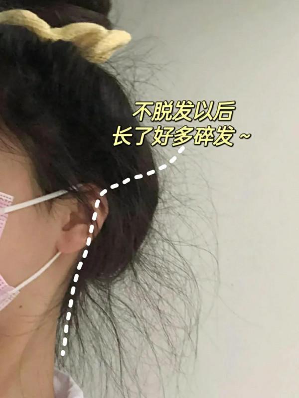 頭髮回來啦，原來養髮是這麼簡單