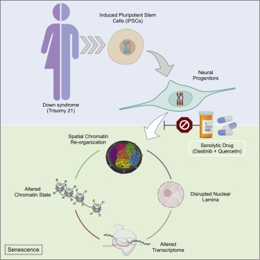 研究：在唐氏綜合症細胞中 全基因組的破壞模擬了類似衰老的狀態