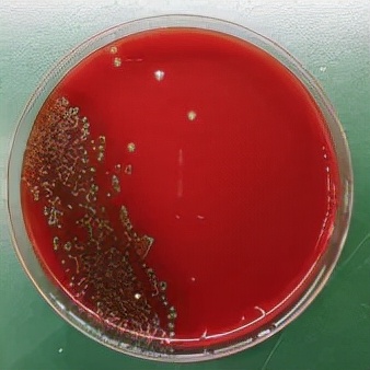 一隻基圍蝦引發的“血案”!常吃海鮮的人要注意 一隻基圍蝦引發的“血案”!常吃海鮮的人要注意